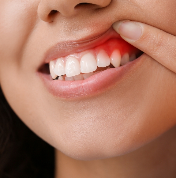 A dentist examining a person’s mouth.