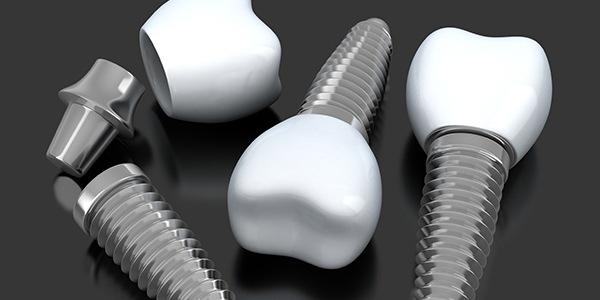 Animation of dental implants