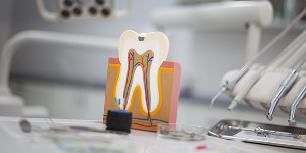 Model of the inside of the tooth